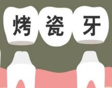 1200一颗的全瓷牙能做吗？全瓷牙费用影响因素盘点！