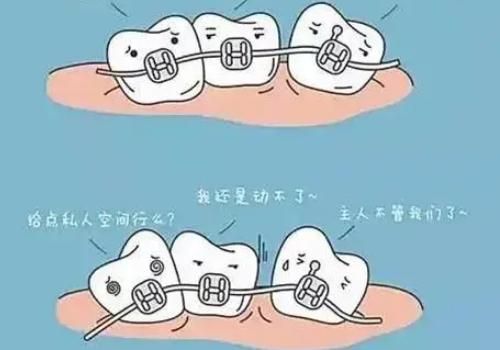 牙齿矫正5.jpg